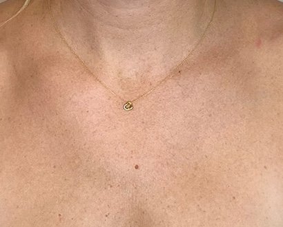 Before: Lumecca Peak (Neck)