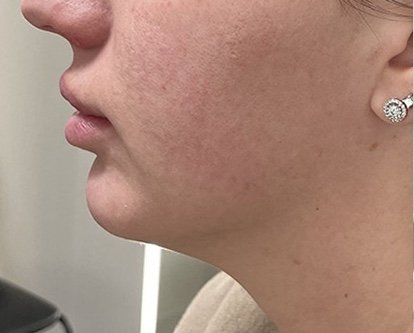Before: Quantum 10